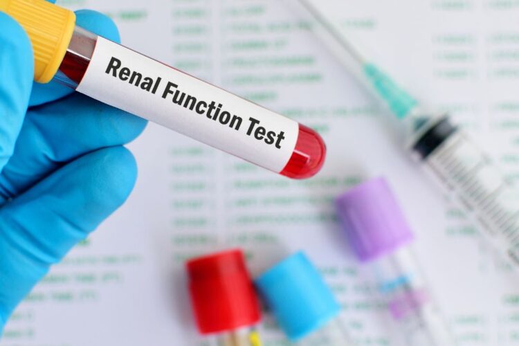 RFT (Renal Function Test)